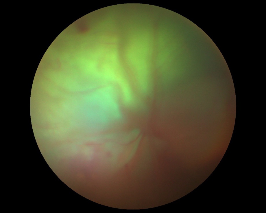 Рисунок 2. Офтальмоскопическая картина глазного дна кошки при тотальной ОС.