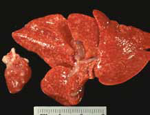 Легкие с пневмонией и некроз в сердце у котенка, врожденно инфицированного Toxoplasma gondii [17]