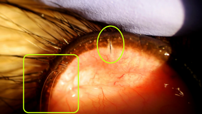 Эктопические ресницы в ветеринарной офтальмологии/Ectopic eyelashes in veterinary ophthalmology