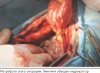 Клинический случай ортотопического уретероцеле у молодой собаки / Orthotopic ureterocele in dog. Clinical case report