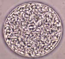 Тканевая циста Toxoplasma gondii из мозго- вой эмульсии экспериментально инфициро- ванной мыши демонстрирует тонкую стенку цисты и банановидной формы брадизоиты (неокрашенный мазок, × 1000) [17]