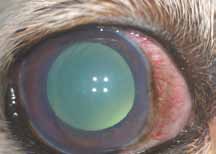 Самоед с первичной закрытоугольной терминальной глаукомой правого глаза. Признаки застоя ДЗН, перипапиллярная отслойка сетчатки с кровоизлияниями и патологические изменения по ФАГ . Левый глаз на момент осмотра стабилен