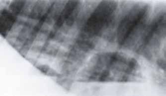 Рентгенологический снимок грудной полости у одной лошади с плевропневмонией