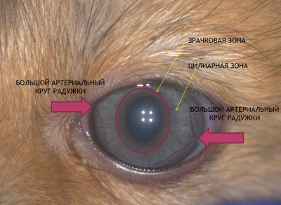 Персистирующие зрачковые мембраны /Persistent Pupillary Membranes