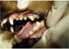 Периапикальное воспаление (воспаление в области верхушки корня зуба)