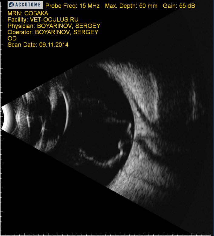 Рисунок 11. Ультрасонографическая картина глаза при ОС у собак. Слева – в результате дисплазии сетчатки, справа – в результате люксации хрусталика.