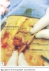            / Long obstruction and hyper dilatation of a bile duct in tomcat. Clinical case report