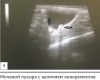       .      / Clinical case of intraluminary ureteral obstruction in a dog. An integrated approach of disease diagnostics